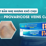 Vết bầm nhẹ nhưng gây khó chịu - nay đã có Provaricose Veins Care
