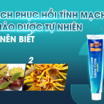  3 CÁCH PHỤC HỒI TĨNH MẠCH TỪ THẢO DƯỢC TỰ NHIÊN BẠN NÊN BIẾT 