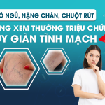 KHÓ NGỦ, NẶNG CHÂN, CHUỘT RÚT - ĐỪNG XEM THƯỜNG TRIỆU CHỨNG SUY GIÃN TĨNH MẠCH
