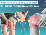 Nguyên Nhân Gây Ra Đau Đầu Gối: Tìm Hiểu Để Phòng Ngừa Hiệu Quả