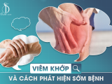 VIÊM KHỚP VÀ CÁCH PHÁT HIỆN SỚM BỆNH