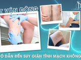 ÍT VẬN ĐỘNG CÓ DỄ DẪN ĐẾN BỆNH SUY GIÃN TĨNH MẠCH KHÔNG?