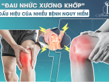 ĐAU NHỨC XƯƠNG KHỚP - DẤU HIỆU CỦA NHIỀU BỆNH NGUY HIỂM