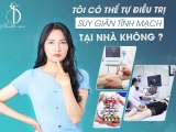 TÔI CÓ THỂ TỰ ĐIỀU TRỊ SUY GIÃN TĨNH MẠCH TẠI NHÀ KHÔNG?