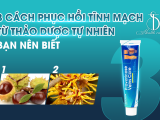  3 CÁCH PHỤC HỒI TĨNH MẠCH TỪ THẢO DƯỢC TỰ NHIÊN BẠN NÊN BIẾT 