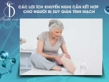 Các lợi ích khuyến nghị cần kết hợp cho người bị suy giãn tĩnh mạch