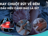 Hay chuột rút về đêm - Dấu hiệu cảnh báo là gì?