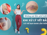 NHỮNG SAI LẦM PHỔ BIẾN KHI XỬ LÝ VẾT BẦM - CÓ THỂ BẠN ĐANG LẦM TƯỞNG