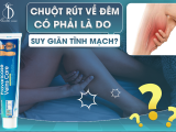 CHUỘT RÚT VỀ ĐÊM CÓ PHẢI LÀ DO SUY GIÃN TĨNH MẠCH?