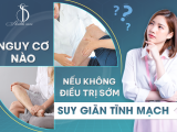 NGUY CƠ NÀO NẾU KHÔNG ĐIỀU TRỊ SỚM SUY GIÃN TĨNH MẠCH?