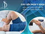 Các liệu pháp y khoa hiện nay dùng để điều trị bệnh suy giãn tĩnh mạch 