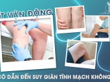 ÍT VẬN ĐỘNG CÓ DẪN ĐẾN SUY GIÃN TĨNH MẠCH KHÔNG?