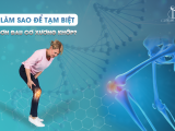 LÀM SAO ĐỂ TẠM BIỆT CƠN ĐAU CƠ XƯƠNG KHỚP?