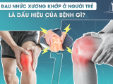 ĐAU NHỨC XƯƠNG KHỚP Ở NGƯỜI TRẺ LÀ DẤU HIỆU CỦA BỆNH GÌ?