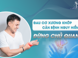 ĐAU CƠ XƯƠNG KHỚP - CĂN BỆNH NGUY HIỂM - ĐỪNG CHỦ QUAN