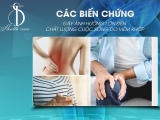 Các biến chứng gây ảnh hưởng lớn đến chất lượng sống do đau viêm khớp?