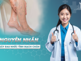 NGUYÊN NHÂN GÂY ĐAU NHỨC TĨNH MẠCH CHÂN