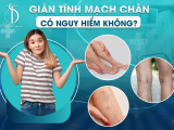 Giãn Tĩnh Mạch Chân Có Nguy Hiểm Không?