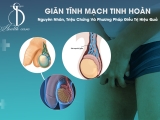 Giãn Tĩnh Mạch Tinh Hoàn - Nguyên Nhân, Triệu Chứng Và Phương Pháp Điều Trị Hiệu Quả