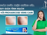 Ngăn Ngừa Triệu Chứng Của Suy Giãn Tĩnh Mạch Với Provaricose Veins Care