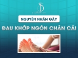 Nguyên Nhân Gây Đau Khớp Ngón Chân Cái