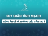Suy Giãn Tĩnh Mạch Và Những Điều Cần Lưu Ý