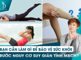 BẠN CẦN LÀM GÌ ĐỂ BẢO VỆ SỨC KHỎE TRƯỚC NGUY CƠ SUY GIÃN TĨNH MẠCH?