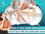 Bệnh Lý Suy Giãn Tĩnh Mạch Có Gây Nguy Hiểm Cho Người Bệnh Không?