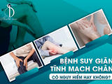 Nguyên Nhân Và Cách Điều Trị Bệnh Viêm Khớp
