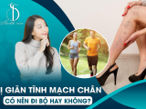 Bị Giãn Tĩnh Mạch Chân Có Nên Đi Bộ Hay Không?