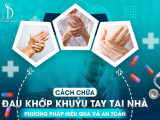 Cách Chữa Đau Khớp Khuỷu Tay Tại Nhà - Phương Pháp Hiệu Quả Và An Toàn