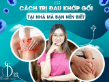 CÁCH TRỊ ĐAU KHỚP GỐI TẠI NHÀ MÀ BẠN NÊN BIẾT