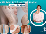 CHĂM SÓC SUY GIÃN TĨNH MẠCH: TỪ NHẸ ĐẾN NẶNG