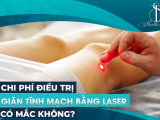 Chi Phí Điều Trị Giãn Tĩnh Mạch Bằng Laser Có Mắc Không?