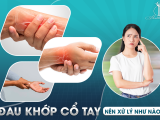 ĐAU KHỚP CỔ TAY NÊN XỬ LÝ NHƯ NÀO?