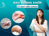 ĐAU XƯƠNG KHỚP - CÓ NGUY HIỂM KHÔNG?