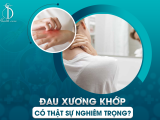 ĐAU XƯƠNG KHỚP CÓ THẬT SỰ NGHIÊM TRỌNG?