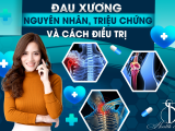 Đau Xương: Nguyên Nhân, Triệu Chứng Và Cách Điều Trị
