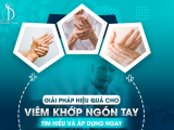 Giải Pháp Hiệu Quả Cho Viêm Khớp Ngón Tay: Tìm Hiểu và Áp Dụng Ngay