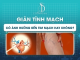 GIÃN TĨNH MẠCH CÓ ẢNH HƯỞNG ĐẾN TIM MẠCH HAY KHÔNG?