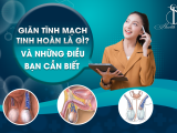 Giãn Tĩnh Mạch Tinh Hoàn Là Gì? Và Những Điều Bạn Cần Biết