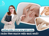 Hướng Dẫn Cách Xoa Bóp Chân Bị Giãn Tĩnh Mạch Hiệu Quả Nhất