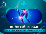 Khớp Gối Bị Đau: Cách Xử Lý Hiệu Quả Để Đảm Bảo Sức Khỏe