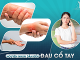 Nguyên Nhân Dẫn Đến Đau Cổ Tay