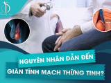 Nguyên Nhân Nào Dẫn Đến Giãn Tĩnh Mạch Thừng Tinh?