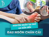 Nguyên Nhân Tại Sao Lại Dẫn Đến Đau Ngón Chân Cái