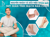 Nguyên Nhân Và Dấu Hiệu Nhận Biết Suy Giãn Tĩnh Mạch Bàn Chân 