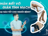 Nhận Biết Vớ Giãn Tĩnh Mạch Loại Nào Tốt Cho Người Bệnh?