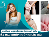 Những Nguyên Nhân Phổ Biến Gây Đau Khớp Ngón Chân Cái
