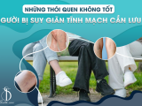 NHỮNG THÓI QUEN KHÔNG TỐT - NGƯỜI BỊ SUY GIÃN TĨNH MẠCH CẦN LƯU Ý